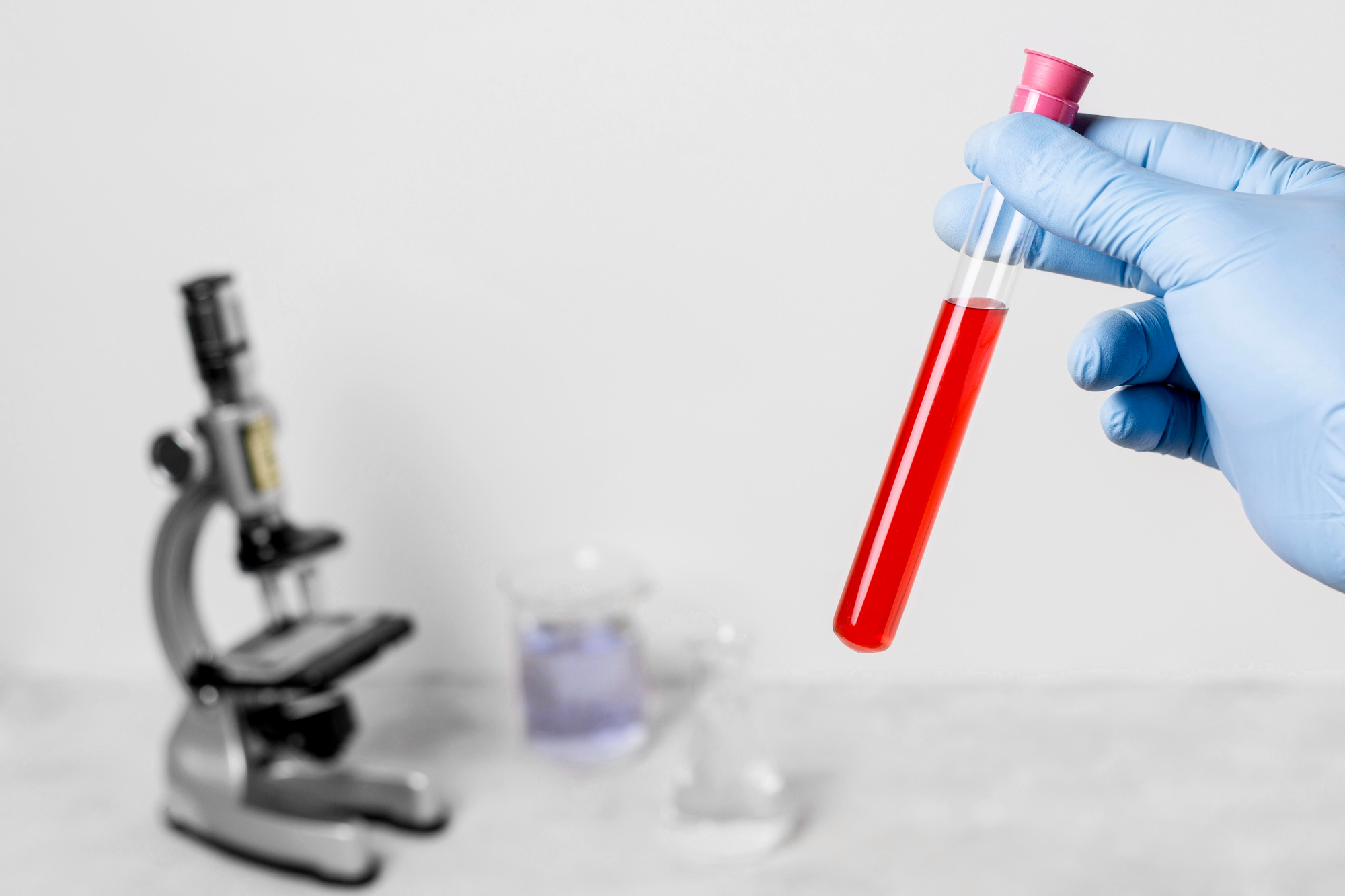 MCH Levels in Blood Tests: What Do They Mean?